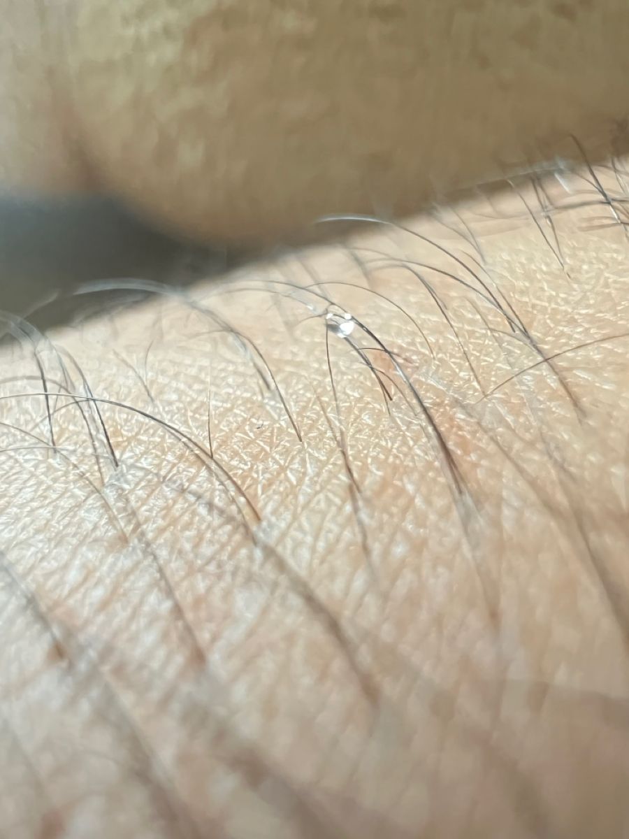Chu kỳ phát triển tự nhiên của sợi lông