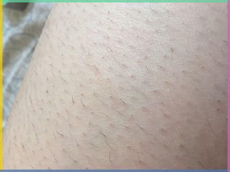 Lông quá ngắn thì lông sẽ không đi sạch 
