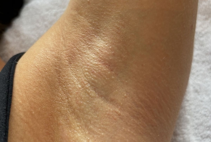 Wax lông nách có bị thâm không? 4 Sai lầm xỉn màu da