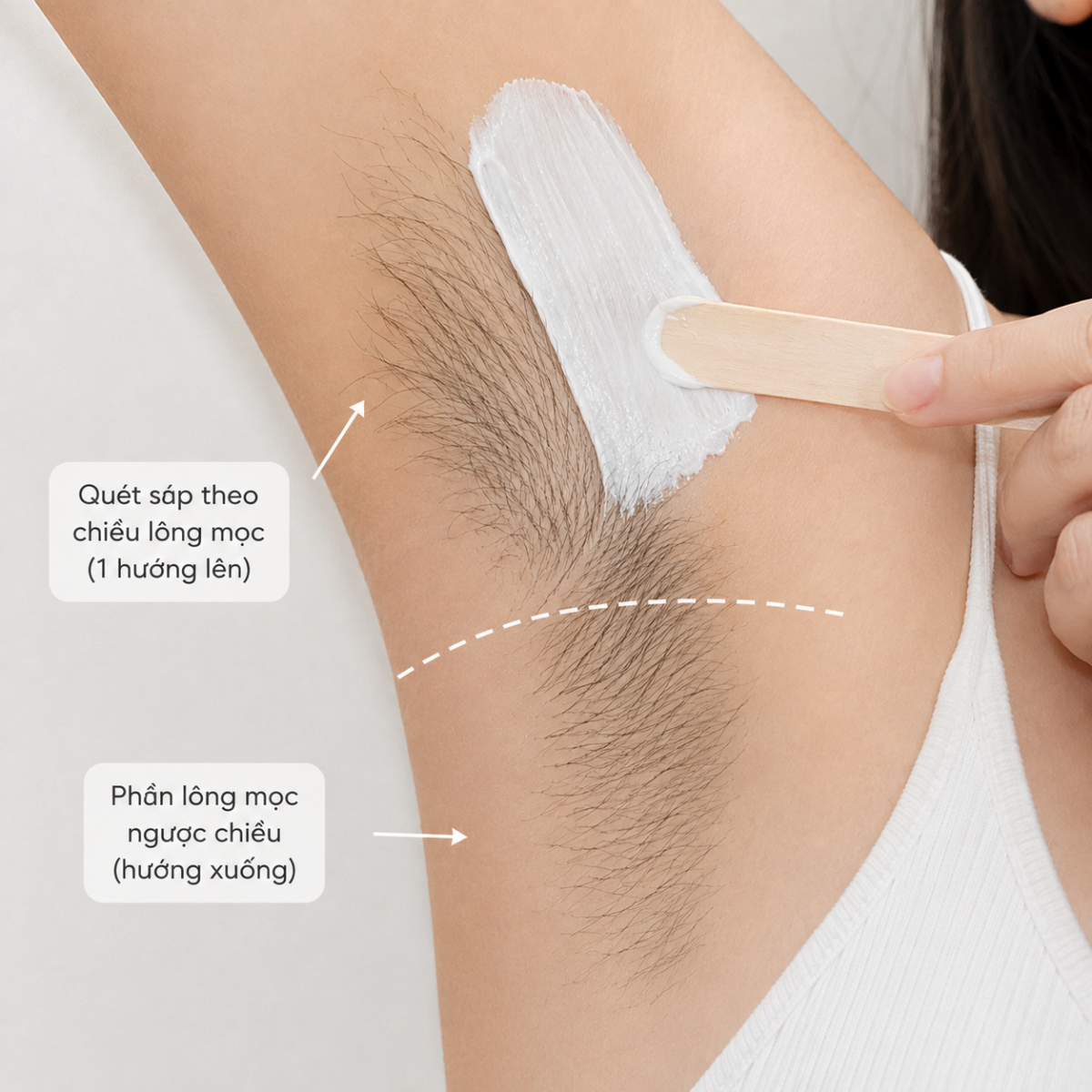 Quết sáp phần lông nách nửa trên