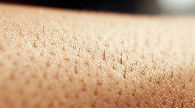 Lông mọc lại sau wax