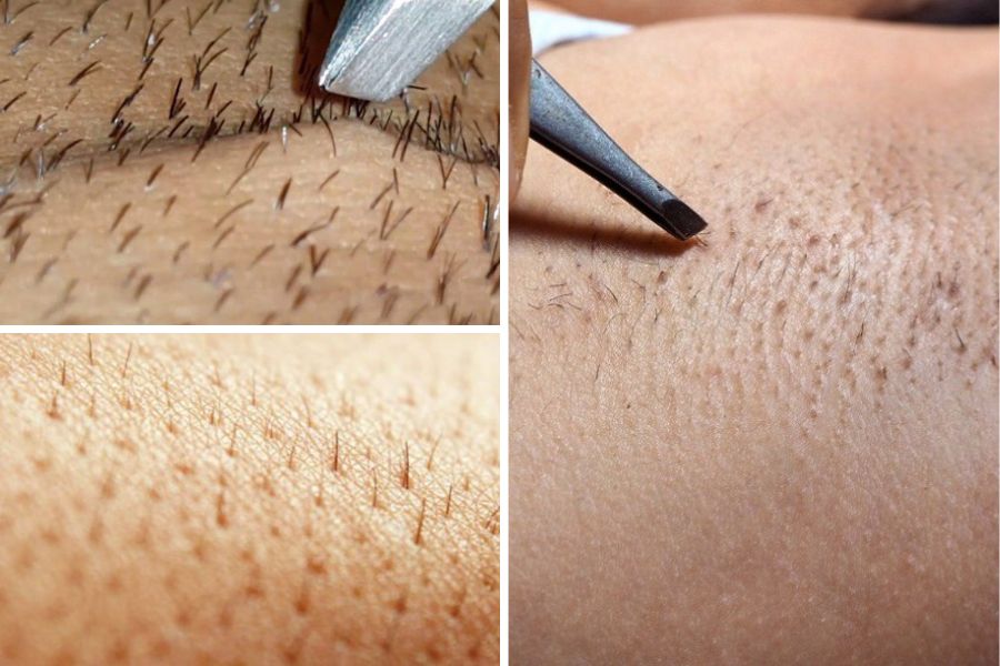 Wax có gây lông mọc dày và rậm hơn