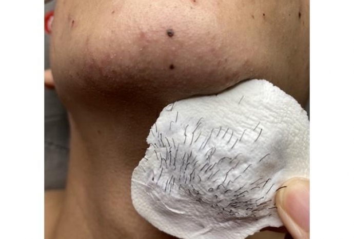 Giải đáp thắc mắc cho các waxer