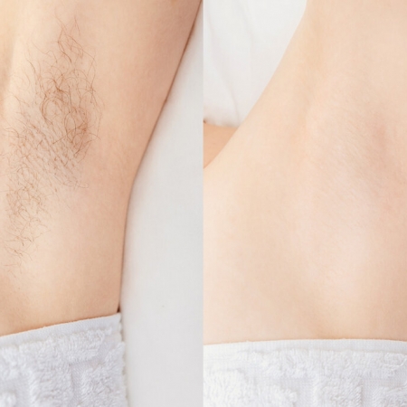 Tips Wax Nách Không Lo Bị Thâm Sạm Da